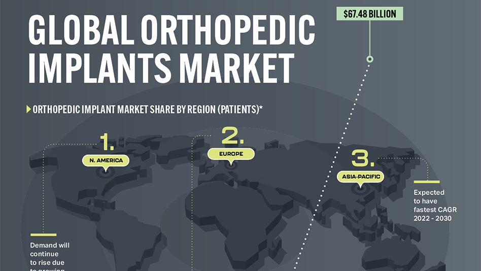 Global Orthopedic Implants Market Today S Medical Developments