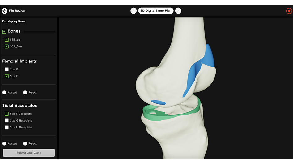 3D Systems’ VSP Connect - Today's Medical Developments