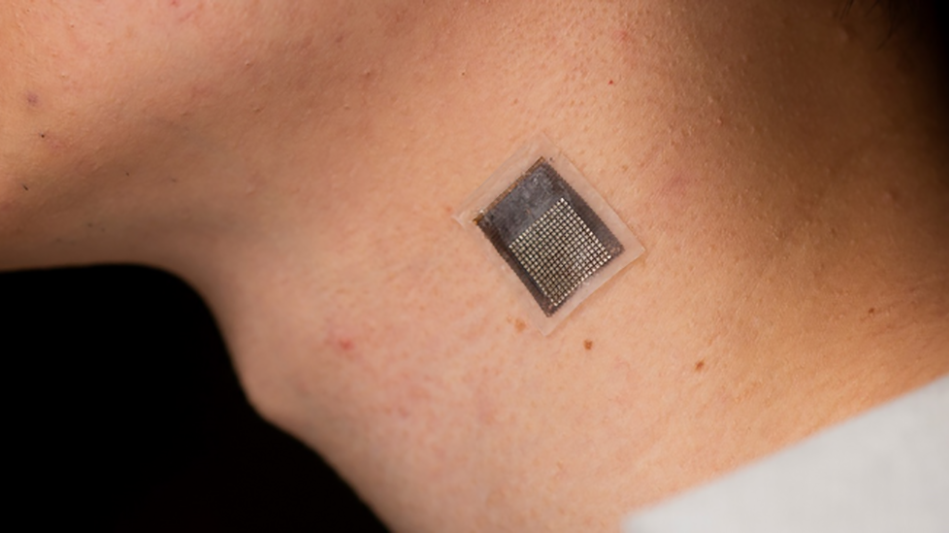 Wearable ultrasound patch for noninvasive deep tissue monitoring Today's Medical Developments