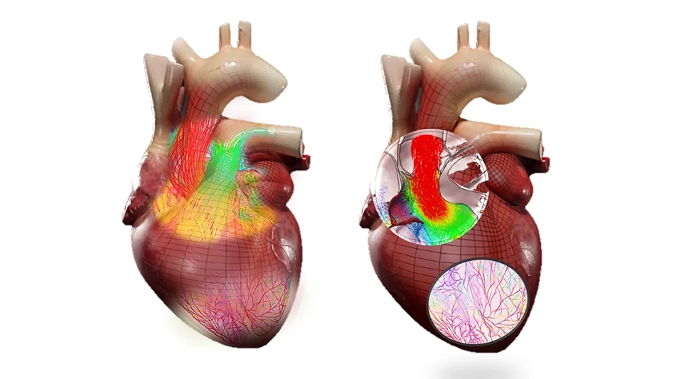 heart-with-aortic-flow.jpg.webp